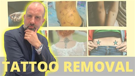 Tattoo Removal UK - Stockport